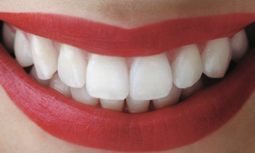 estetica del sorriso