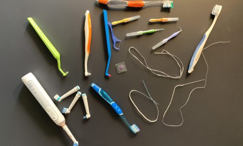 terapia parodontale di supporto
